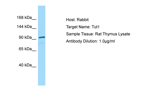 TUT1 Antibody -  This image was taken for the unconjugated form of this product. Other forms have not been tested.