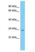 TVP23C Antibody - TVP23C antibody Western Blot of HeLa. Antibody dilution: 1 ug/ml.  This image was taken for the unconjugated form of this product. Other forms have not been tested.