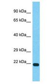 TVP23C Antibody - TVP23C antibody Western Blot of MCF7. Antibody dilution: 1 ug/ml.  This image was taken for the unconjugated form of this product. Other forms have not been tested.