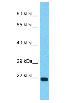 TVP23C Antibody - TVP23C antibody Western Blot of MCF7. Antibody dilution: 1 ug/ml.  This image was taken for the unconjugated form of this product. Other forms have not been tested.