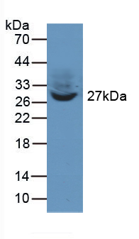 TWF1 / PTK9 Antibody