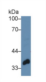 TWF1 / PTK9 Antibody