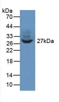 TWF1 / PTK9 Antibody - Sample: recombinant human TWF1.