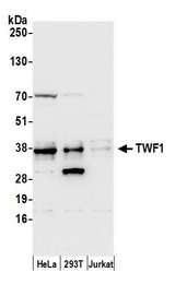 TWF1 / PTK9 Antibody - Detection of human TWF1 by western blot. Samples: Whole cell lysate (50 µg) from HeLa, HEK293T, and Jurkat cells prepared using NETN lysis buffer. Antibody: Affinity purified rabbit anti-TWF1 antibody used for WB at 0.1 µg/ml. Detection: Chemiluminescence with an exposure time of 3 seconds.