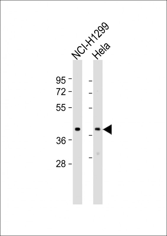 TWF1 / PTK9 Antibody - All lanes: Anti-TWF1 Antibody (Center) at 1:2000 dilution. Lane 1: NCI-H1299 whole cell lysate. Lane 2: HeLa whole cell lysate Lysates/proteins at 20 ug per lane. Secondary Goat Anti-Rabbit IgG, (H+L), Peroxidase conjugated at 1:10000 dilution. Predicted band size: 40 kDa. Blocking/Dilution buffer: 5% NFDM/TBST.