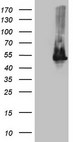 TWF1 / PTK9 Antibody - HEK293T cells were transfected with the pCMV6-ENTRY control. (Left lane) or pCMV6-ENTRY TWF1. (Right lane) cDNA for 48 hrs and lysed. Equivalent amounts of cell lysates. (5 ug per lane) were separated by SDS-PAGE and immunoblotted with anti-TWF1. (1:2000)