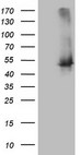 TWF1 / PTK9 Antibody - HEK293T cells were transfected with the pCMV6-ENTRY control. (Left lane) or pCMV6-ENTRY TWF1. (Right lane) cDNA for 48 hrs and lysed