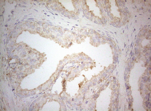 TWF1 / PTK9 Antibody - Immunohistochemical staining of paraffin-embedded Human prostate tissue within the normal limits using anti-TWF1 mouse monoclonal antibody. (Heat-induced epitope retrieval by 1mM EDTA in 10mM Tris buffer. (pH8.5) at 120°C for 3 min. (1:150)