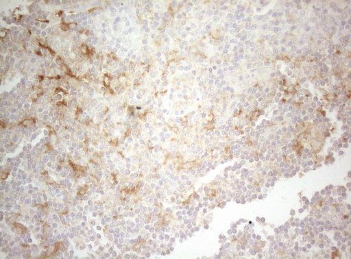 TWF1 / PTK9 Antibody - Immunohistochemical staining of paraffin-embedded Human lymph node tissue within the normal limits using anti-TWF1 mouse monoclonal antibody. (Heat-induced epitope retrieval by 1mM EDTA in 10mM Tris buffer. (pH8.5) at 120°C for 3 min. (1:150)