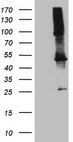 TWF1 / PTK9 Antibody - HEK293T cells were transfected with the pCMV6-ENTRY control. (Left lane) or pCMV6-ENTRY TWF1. (Right lane) cDNA for 48 hrs and lysed