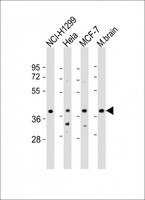 TWF1 / PTK9 Antibody - All lanes: Anti-TWF1 Antibody (Center) at 1:2000 dilution. Lane 1: NCI-H1299 whole cell lysate. Lane 2: HeLa whole cell lysate. Lane 3: MCF-7 whole cell lysate. Lane 4: mouse brain lysate Lysates/proteins at 20 ug per lane. Secondary Goat Anti-Rabbit IgG, (H+L), Peroxidase conjugated at 1:10000 dilution. Predicted band size: 40 kDa. Blocking/Dilution buffer: 5% NFDM/TBST.