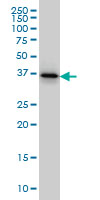 TWF1 / PTK9 Antibody - PTK9 monoclonal antibody (M02), clone 1E2 Western blot of PTK9 expression in HeLa.