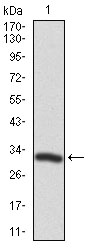 TWF1 / PTK9 Antibody - Western blot using TWF1 monoclonal antibody against human TWF1 recombinant protein. (Expected MW is 31.1 kDa)