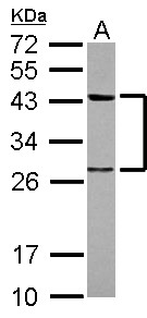 TWF1 / PTK9 Antibody - Sample (30 ug of whole cell lysate) A: HeLa 12% SDS PAGE TWF1 / PTK9 antibody diluted at 1:1000