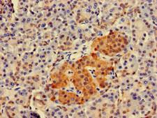 TWF1 / PTK9 Antibody - Immunohistochemistry of paraffin-embedded human pancreatic tissue at dilution of 1:100