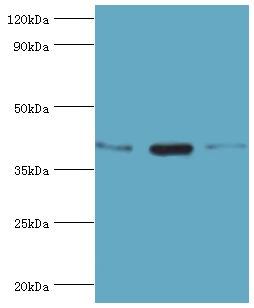TWF2 / PTK9L Antibody - Western blot. All lanes: Twinfilin-2 antibody at 3 ug/ml. Lane 1: Jurkat whole cell lysate. Lane 2: HepG2 whole cell lysate. Lane 3: A431 whole cell lysate. Secondary antibody: Goat polyclonal to rabbit at 1:10000 dilution. Predicted band size: 40 kDa. Observed band size: 40 kDa.