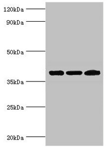 TWF2 / PTK9L Antibody - Western blot All lanes: Twinfilin-2 antibody at 3µg/ml Lane 1: Jurkat whole cell lysate Lane 2: HepG2 whole cell lysate Lane 3: A431 whole cell lysate Secondary Goat polyclonal to rabbit IgG at 1/10000 dilution Predicted band size: 40 kDa Observed band size: 40 kDa