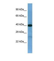 TWF2 / PTK9L Antibody - Western blot of Human PANC1. TWF2 antibody dilution 1.0 ug/ml.  This image was taken for the unconjugated form of this product. Other forms have not been tested.