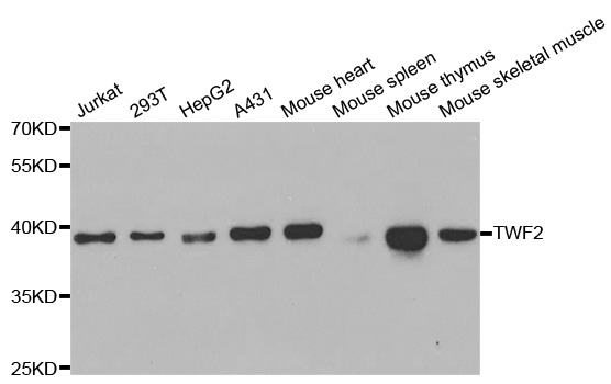 TWF2 / PTK9L Antibody - Western blot analysis of extracts of various cell lines.