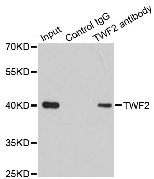 TWF2 / PTK9L Antibody - Immunoprecipitation analysis of 200ug extracts of 293T cells.