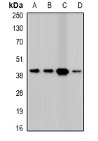 TWF2 / PTK9L Antibody - Western blot analysis of Twinfilin-2 expression in HepG2 (A); A431 (B); mouse heart (C); mouse spleen (D) whole cell lysates.