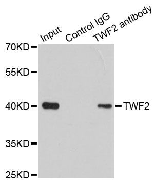 TWF2 / PTK9L Antibody - Immunoprecipitation analysis of 200ug extracts of 293T cells using 1ug TWF2 antibody. Western blot was performed from the immunoprecipitate using TWF2 antibody at a dilition of 1:1000.