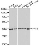 TWF2 / PTK9L Antibody - Western blot analysis of extracts of various cell lines, using TWF2 antibody at 1:1000 dilution. The secondary antibody used was an HRP Goat Anti-Rabbit IgG (H+L) at 1:10000 dilution. Lysates were loaded 25ug per lane and 3% nonfat dry milk in TBST was used for blocking.