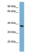 TWF2 / PTK9L Antibody - TWF2 / PTK9L antibody Western Blot of HepG2 cell lysate.  This image was taken for the unconjugated form of this product. Other forms have not been tested.