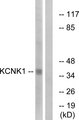 TWIK1 / KCNK1 Antibody - Western blot analysis of lysates from Jurkat cells, using KCNK1 Antibody. The lane on the right is blocked with the synthesized peptide.