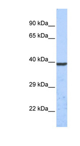 TWIK1 / KCNK1 Antibody - KCNK1 antibody Western blot of Fetal Heart lysate. This image was taken for the unconjugated form of this product. Other forms have not been tested.