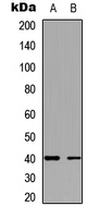 TWIK1 / KCNK1 Antibody - Western blot analysis of TWIK1 expression in HeLa (A); A431 (B) whole cell lysates.