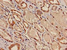 TWIK1 / KCNK1 Antibody - Immunohistochemistry image of paraffin-embedded human kidney tissue at a dilution of 1:100