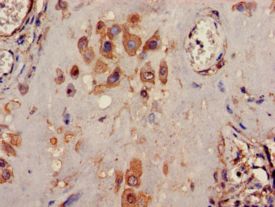 TWIK1 / KCNK1 Antibody - Immunohistochemistry image of paraffin-embedded human placenta tissue at a dilution of 1:100