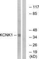 TWIK1 / KCNK1 Antibody - Western blot analysis of extracts from Jurkat cells, using KCNK1 antibody.