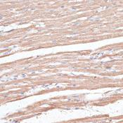 TWIK1 / KCNK1 Antibody - Immunohistochemistry of paraffin-embedded Rat heart using KCNK1 Polyclonal Antibody at dilution of 1:100 (40x lens).