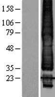 TWIK1 / KCNK1 Protein - Western validation with an anti-DDK antibody * L: Control HEK293 lysate R: Over-expression lysate