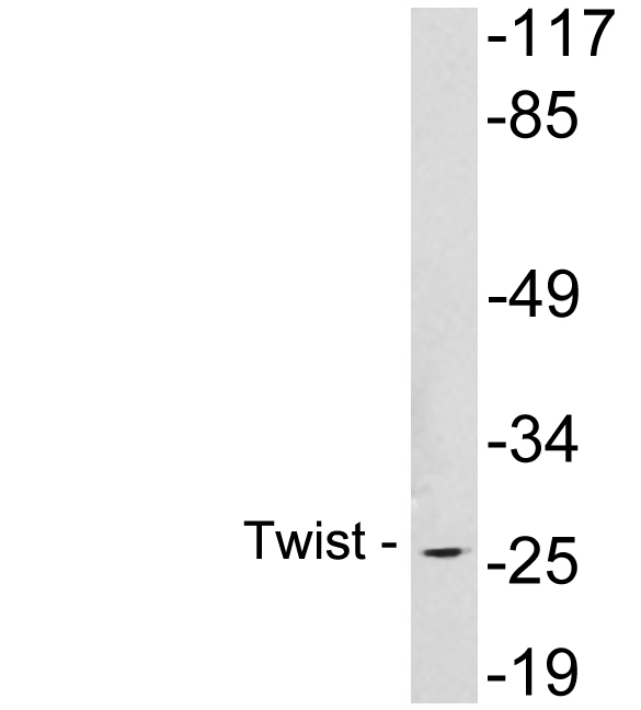 TWIST1 / TWIST Antibody - Western blot analysis of lysates from Jurkat cells , using Twist antibody.