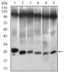 TWIST1 / TWIST Antibody - Western blot using TWIST1 mouse monoclonal antibody against NIH/3T3 (1), JURKAT (2), HELA (3), A549 (4), RAJI (5) and OCM-1 (6) cell lysate.