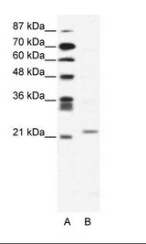 TWIST1 / TWIST Antibody - A: Marker, B: Jurkat Cell Lysate.  This image was taken for the unconjugated form of this product. Other forms have not been tested.
