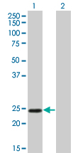 TWIST1 / TWIST Antibody - Western Blot analysis of TWIST1 expression in transfected 293T cell line by TWIST1 monoclonal antibody (M01), clone 3E11.Lane 1: TWIST1 transfected lysate(21 KDa).Lane 2: Non-transfected lysate.