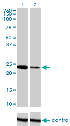 TWIST1 / TWIST Antibody - Western blot analysis of TWIST1 over-expressed 293 cell line, cotransfected with TWIST1 Validated Chimera RNAi (Lane 2) or non-transfected control (Lane 1). Blot probed with TWIST1 monoclonal antibody (M01), clone 3E11 . GAPDH ( 36.1 kDa ) used as specificity and loading control.