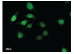 TWIST1 / TWIST Antibody - Immunofluorescent staining using TWIST antibody. Immunostaining analysis in HeLa cells. HeLa cells were fixed with 4% paraformaldehyde and permeabilized with 0.01% Triton-X100 in PBS. The cells were immunostained with anti-TWIST antibody.