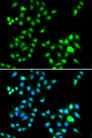 TWIST1 / TWIST Antibody - Immunofluorescence analysis of MCF7 cell using TWIST1 antibody. Blue: DAPI for nuclear staining.