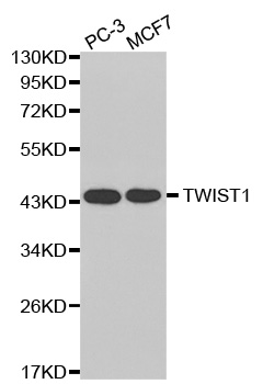 TWIST1 / TWIST Antibody - Western blot blot of extracts of various cell lines, using TWIST1 antibody.
