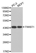 TWIST1 / TWIST Antibody - Western blot blot of extracts of various cell lines, using TWIST1 antibody.