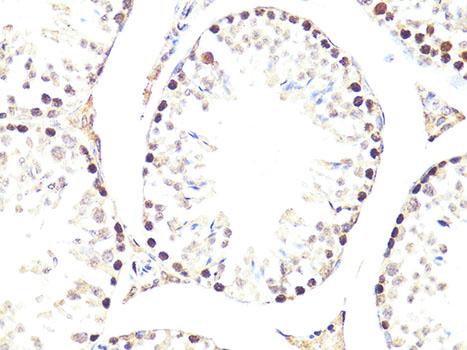 TWIST1 / TWIST Antibody - Immunohistochemistry of paraffin-embedded Mouse testis using Twist Polyclonal Antibody at dilution of 1:100 (40x lens).
