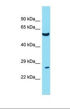 TWIST1 / TWIST Antibody - Western blot of Human Uterus Tumor. TWIST1 antibody dilution 1.0 ug/ml.  This image was taken for the unconjugated form of this product. Other forms have not been tested.