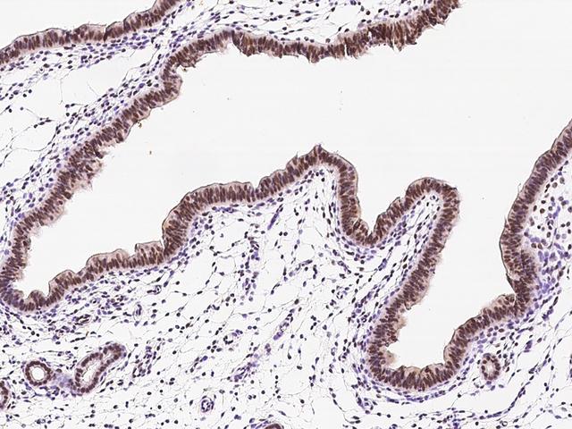 TWIST1 / TWIST Antibody - Immunochemical staining of mouse TWIST1 in mouse uterus with rabbit polyclonal antibody at 1:1000 dilution, formalin-fixed paraffin embedded sections.
