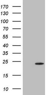 TWIST2 Antibody - HEK293T cells were transfected with the pCMV6-ENTRY control (Left lane) or pCMV6-ENTRY TWIST2 (Right lane) cDNA for 48 hrs and lysed. Equivalent amounts of cell lysates (5 ug per lane) were separated by SDS-PAGE and immunoblotted with anti-TWIST2.