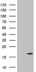 TWIST2 Antibody - HEK293T cells were transfected with the pCMV6-ENTRY control. (Left lane) or pCMV6-ENTRY TWIST2. (Right lane) cDNA for 48 hrs and lysed. Equivalent amounts of cell lysates. (5 ug per lane) were separated by SDS-PAGE and immunoblotted with anti-TWIST2.